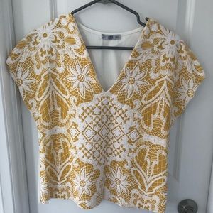Zara top
